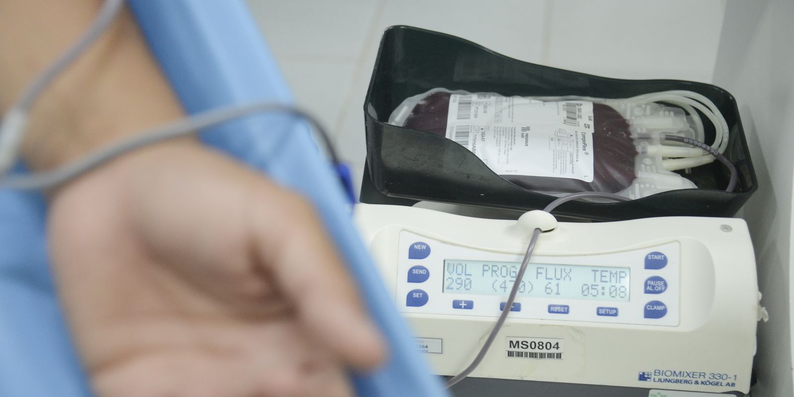 Crianças com hemofilia terão terapia menos invasiva pelo SUS